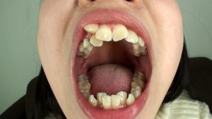 Thumbnail of post image 002